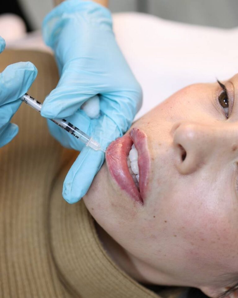 Dermal And Lip Filler Courses Boon Aesthetics