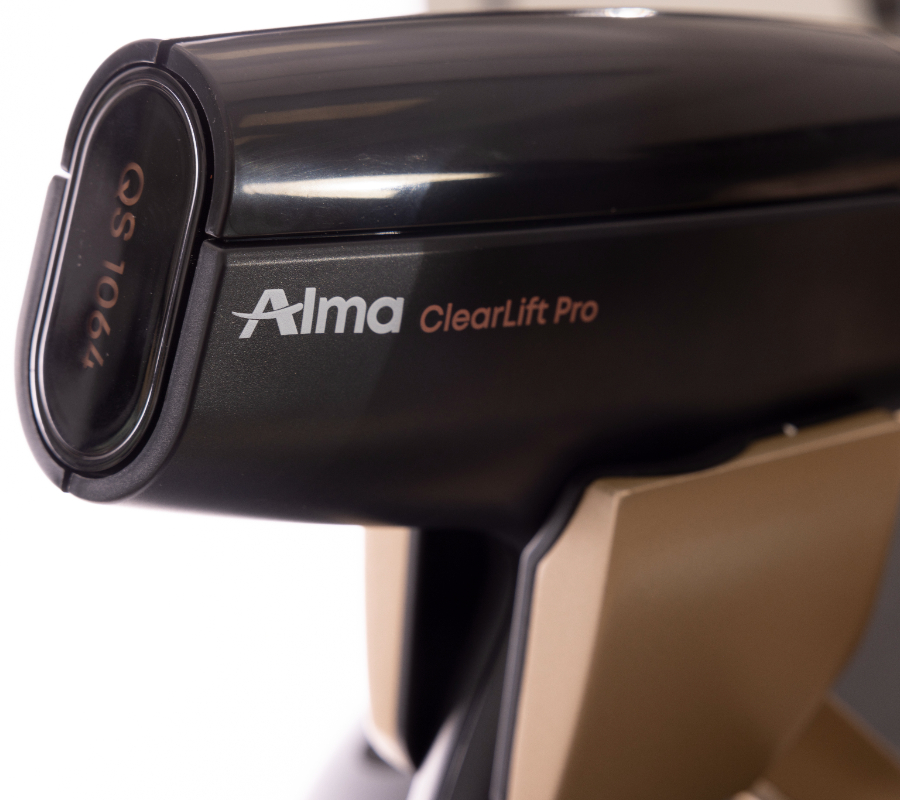 Alma Harmony: Tattoo Removal