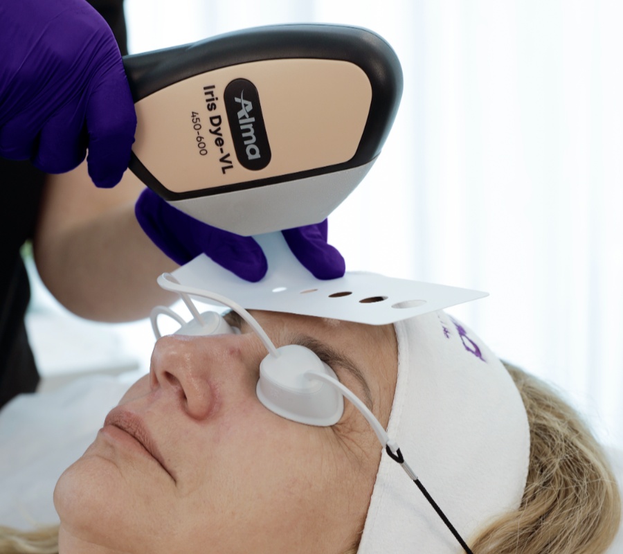 Alma Harmony: Pigmentation